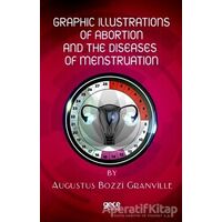 Graphic Illustrations Of Abortion And The Diseases Of Menstruation